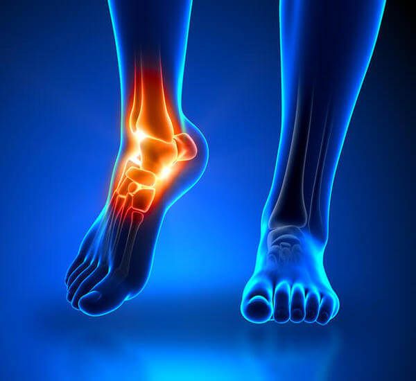 Pathologies de la cheville et du pied